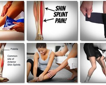 How To Stop Shin Splints Forever in 2023